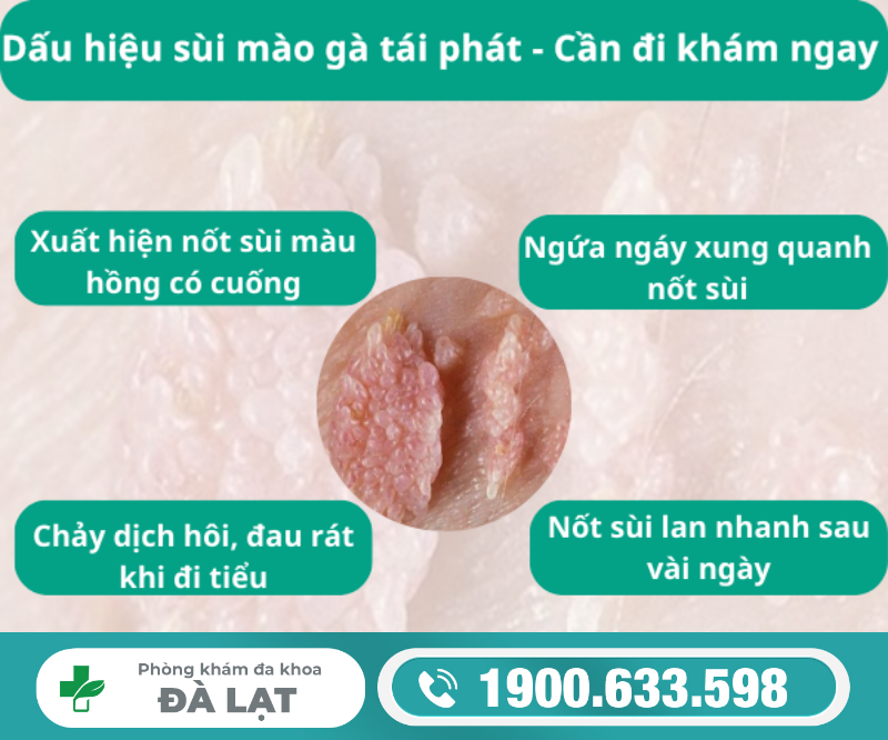 Hình ảnh minh họa